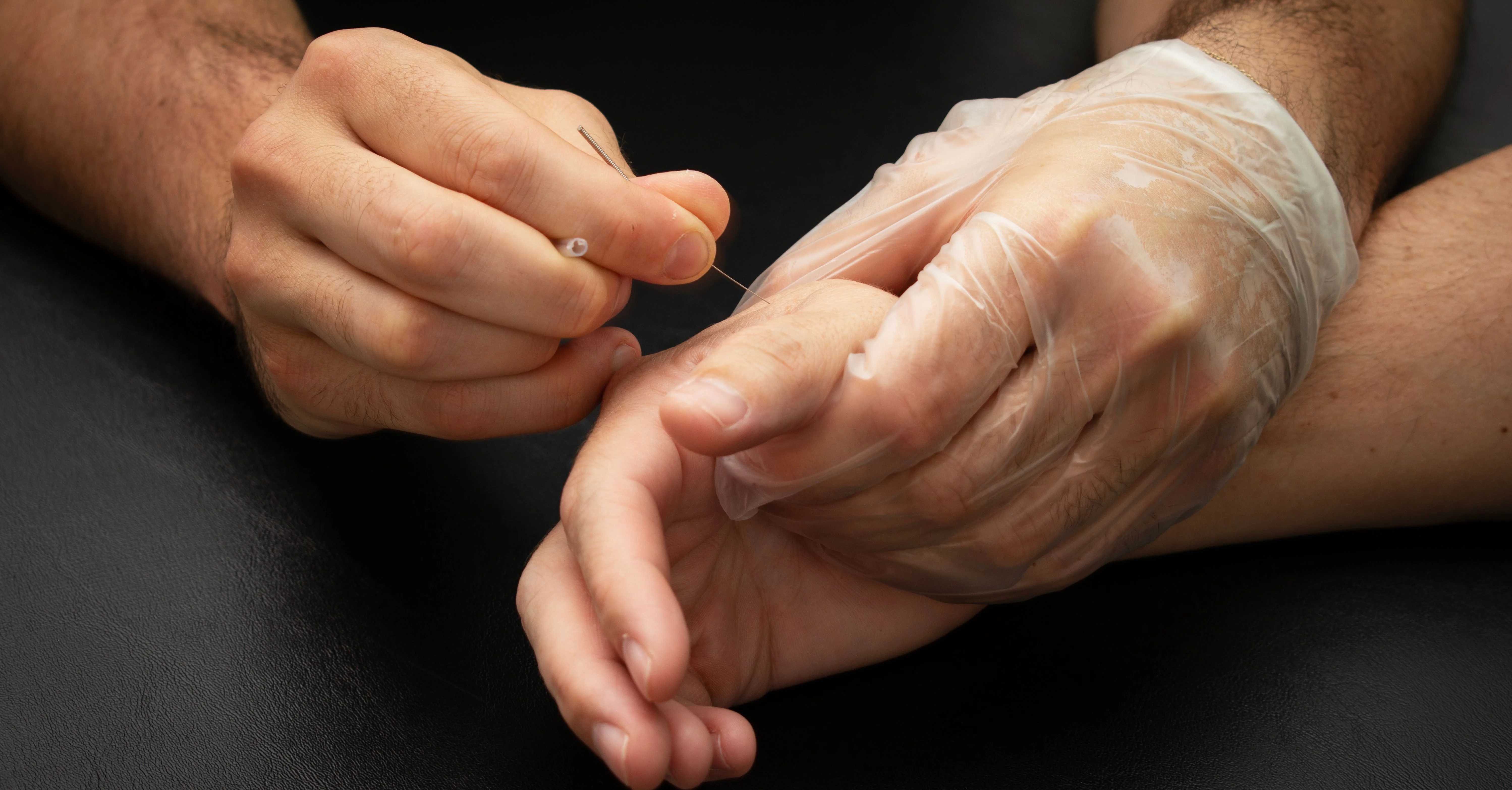 A gloved hand steadying a patient's hand while a fine needle is placed into the muscle below the thumb.